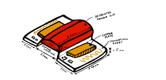 The Use of Capacitive Sensors to Determine Sensor Migration and Loss of Contact in  Transradial Myoelectric Amputees - ABSTRACT